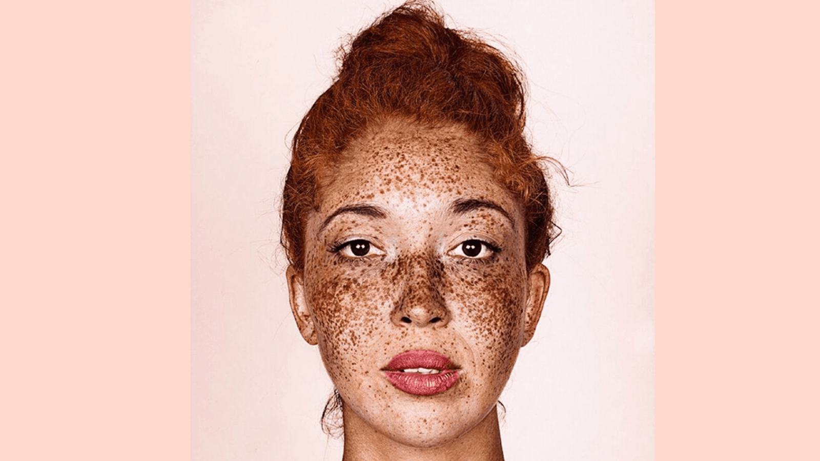 Redhead With Freckles Pic – Telegraph