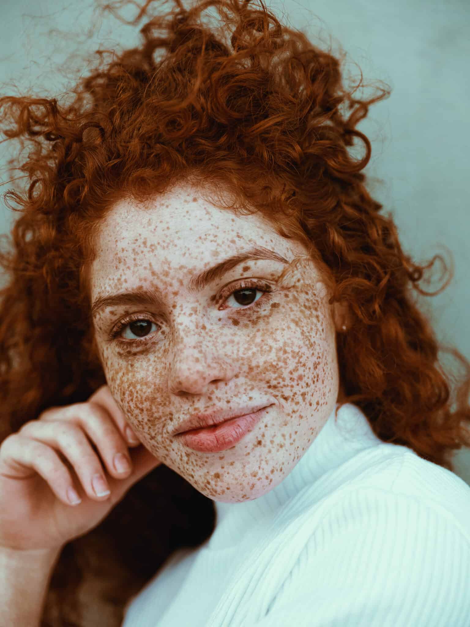 Photographer Captures the Beauty of Freckles in All Their Glory