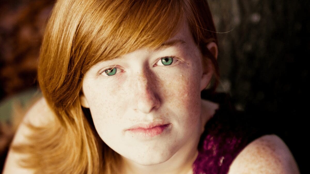 why-do-redheads-get-such-dark-under-eye-circles-h2bar