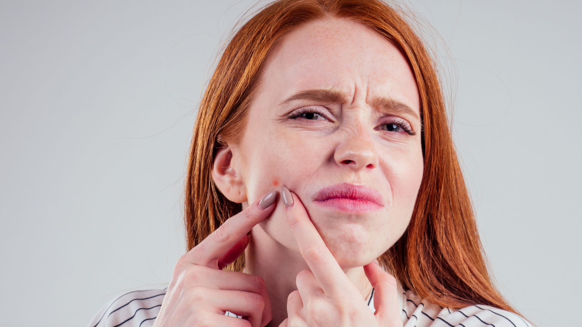 Redheads Can Get Rid Of Pesky Blackheads With These Expert Tips