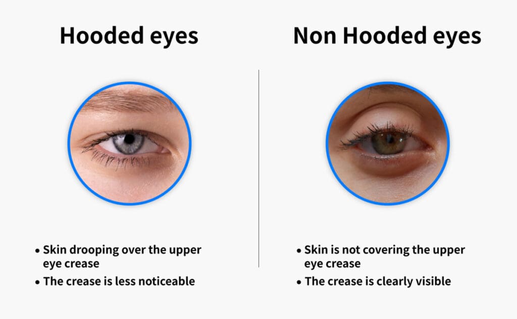 9 Makeup Tips If You Have Hooded Eyes How To Be A Redhead   Hooded Eyes Vs Non Hooded 1200 1024x632 