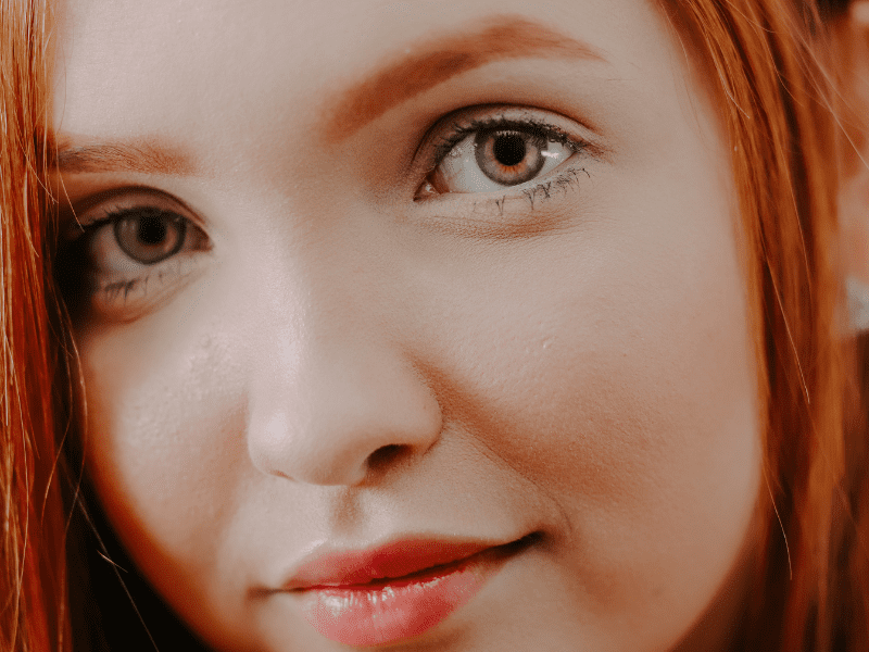 Bumps Under the Eyes: Types & How Redheads Can Treat Them