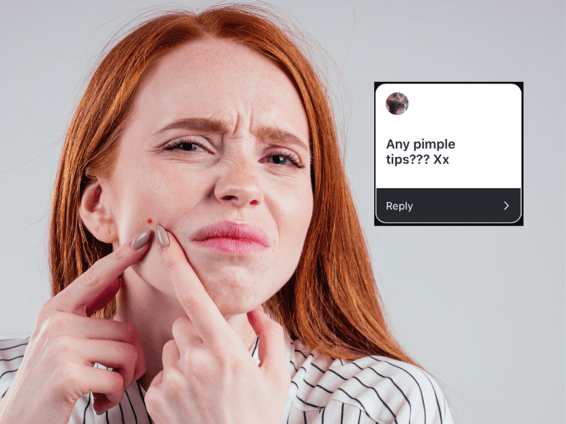 Ask a Redhead: What Are Tips for Preventing Pimples? How Can I Get Rid Of Them?