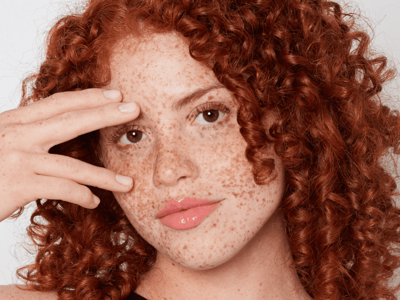 enhance freckles