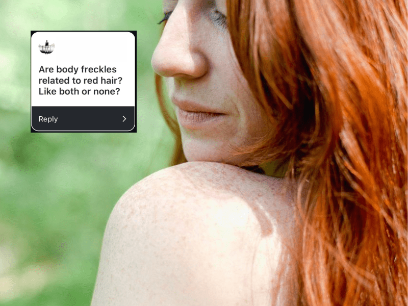 Ask a Redhead: The Link Between Freckles and Redheads