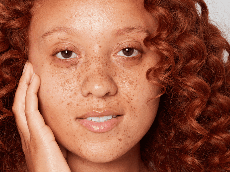 4 Ways for Redheads to Combat Seasonal Dry Skin