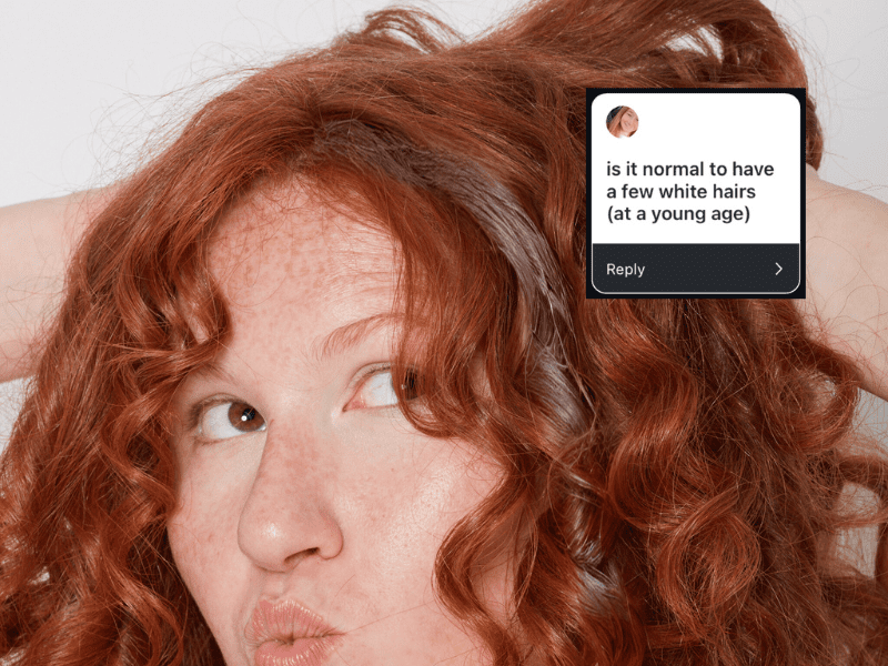 Ask a Redhead: Is Having White Hairs Normal When You’re Young?