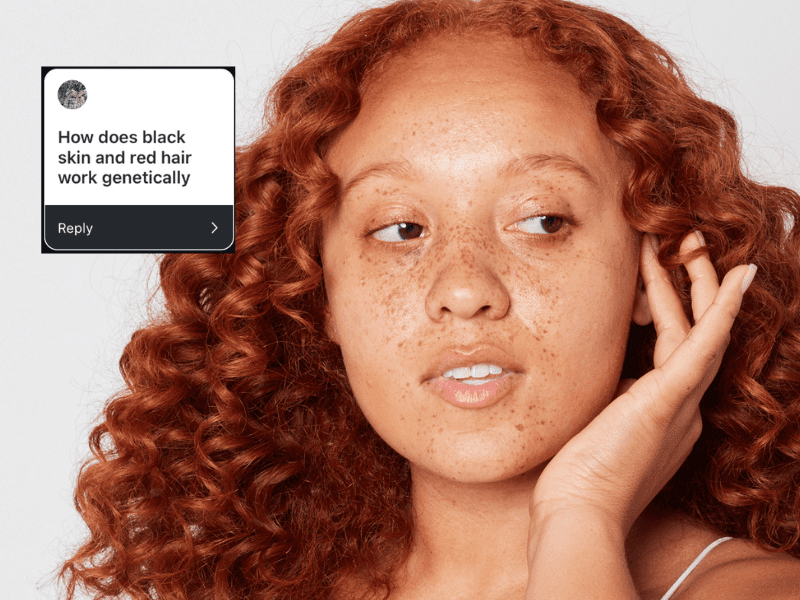 Ask a Redhead: How Do Black Skin and Natural Red Hair Work Genetically?