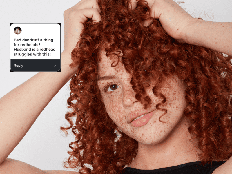 Ask a Redhead: Are Redheads Prone To Dandruff? How Can You Prevent It?