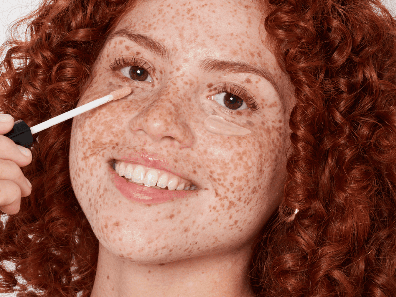 redhead freckles